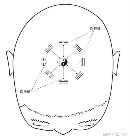 八卦頭針